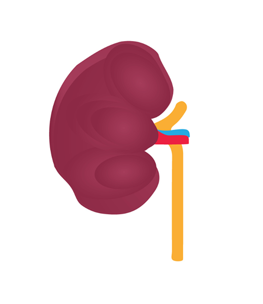 Kidney Stage 3 Image