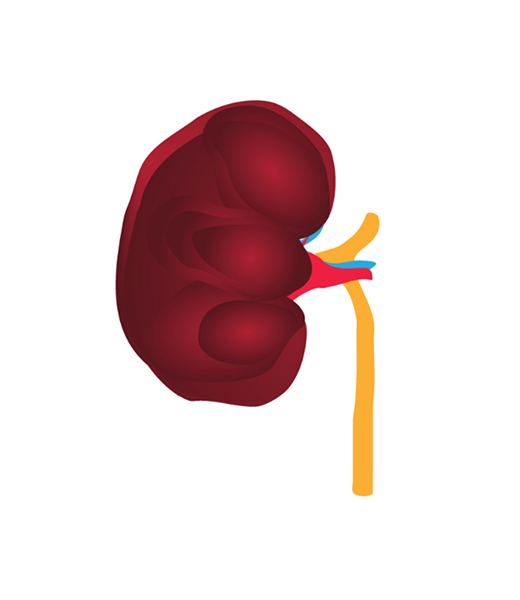 Kidney Stage 4 Image