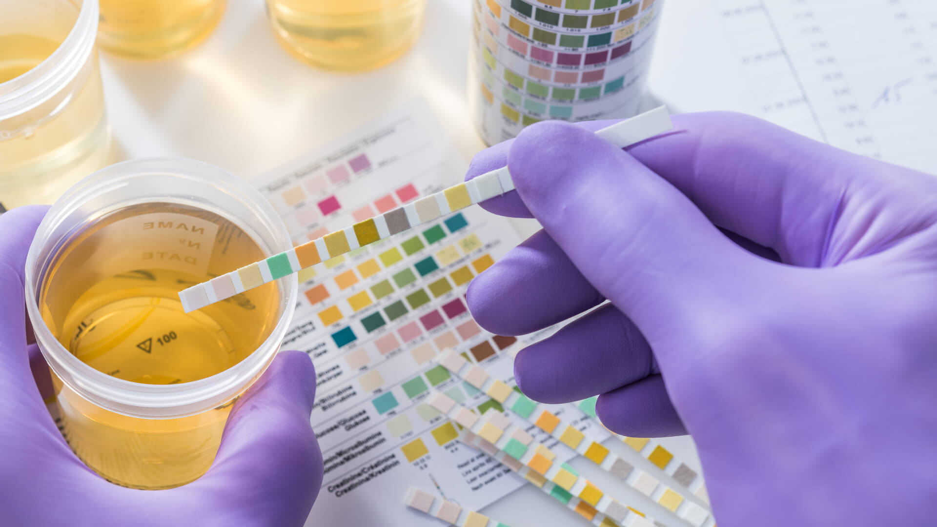 Urine Test Image